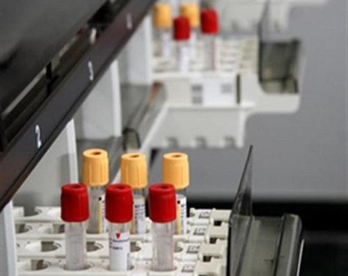 ΜΙΚΡΟΒΙΟΛΟΓΙΚΟ ΕΡΓΑΣΤΗΡΙΟ | ΚΙΑΤΟ ΚΟΡΙΝΘΙΑΣ | ΜΙΚΡΟΒΙΟΛΟΓΟΣ ΠΑΠΑΚΥΡΙΑΚΟΠΟΥΛΟΣ ΝΙΚΟΛΑΟΣ