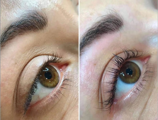 ΚΕΝΤΡΟ ΑΙΣΘΗΤΙΚΗΣ ΕΛΕΥΘΕΡΟΥΠΟΛΗ ΚΑΒΑΛΑ | CHIC BEAUTY SALON