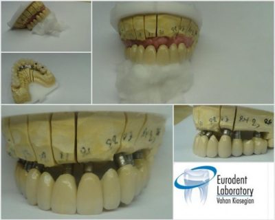 ΟΔΟΝΤΟΤΕΧΝΙΚΟ ΕΡΓΑΣΤΗΡΙΟ ΠΕΙΡΑΙΑΣ | EURODENT LABORATORY - gbd.gr